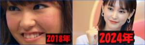 桐谷美玲の2018年と現在を比較