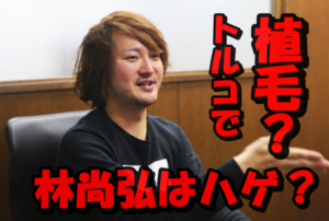 【速報】林尚弘社長のハゲ説がネットで話題!トルコで植毛した結果に衝撃!
